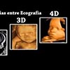 Ecografía 3D y 4D